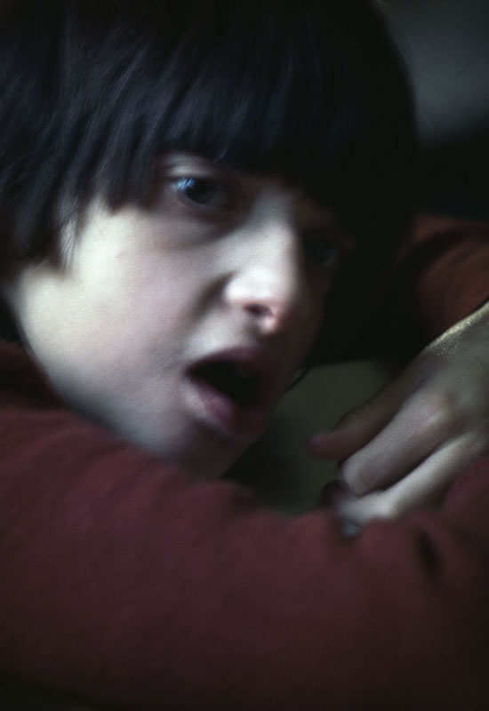 LEGNANO, CENTRO ANFFAS. 1981